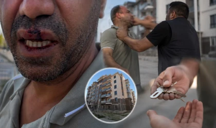 Malatya’da Anahtar Teslimi Polemiği Hastanede Bitti