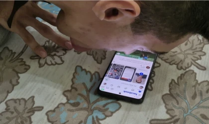 Malatya’da Fiziksel Engelli Burnuyla Dünyaya Açıldı